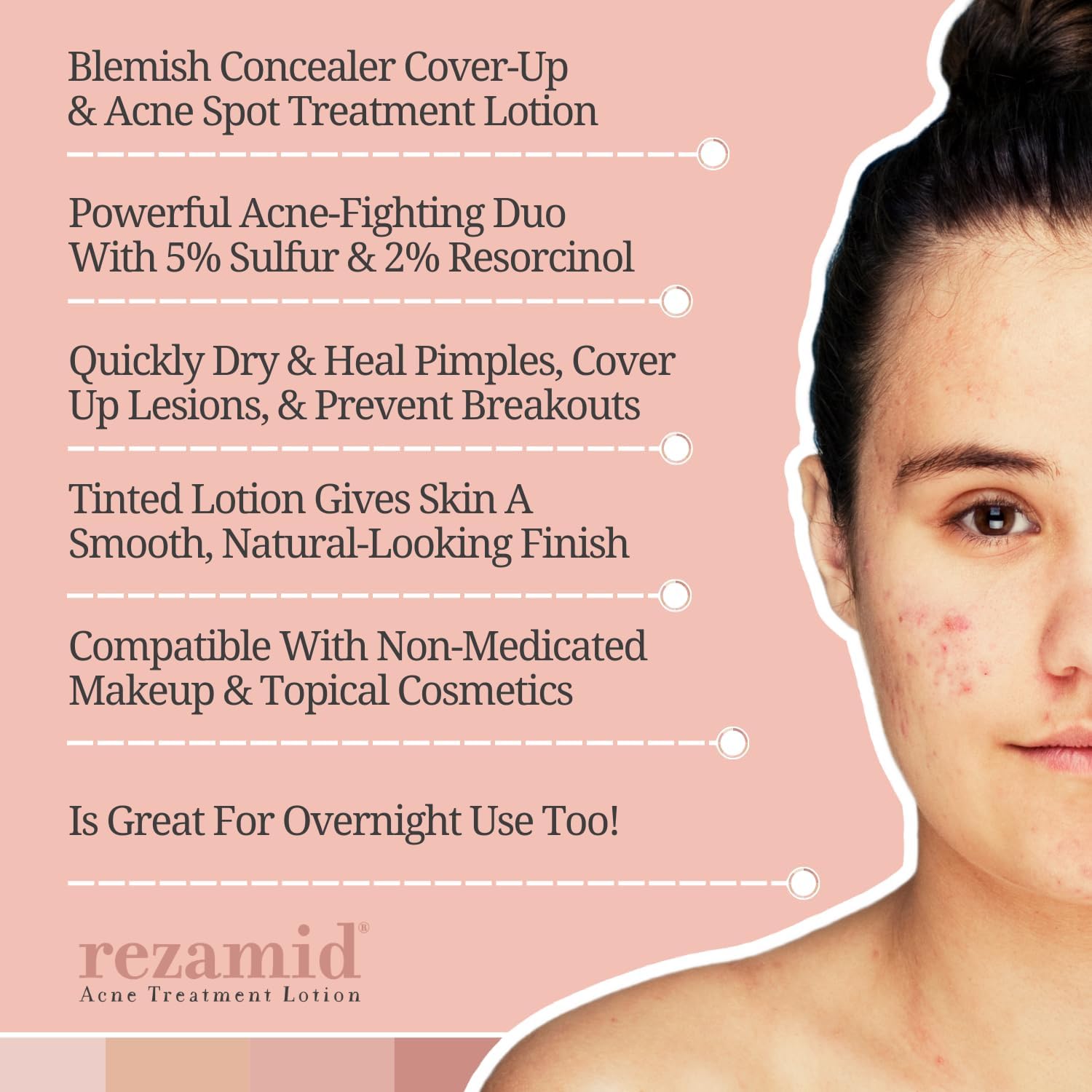 Rezamid Acne Lotion - Medicated Treatment for Clear Skin – Summers