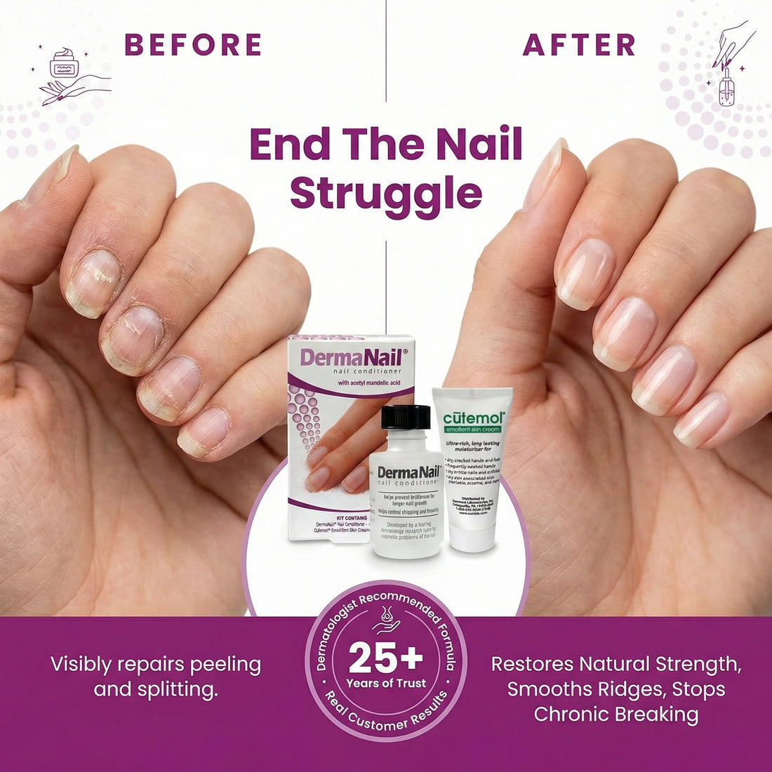 DermaNail Nail Conditioner 1oz - Strengthen & Restore Damaged Nails ...