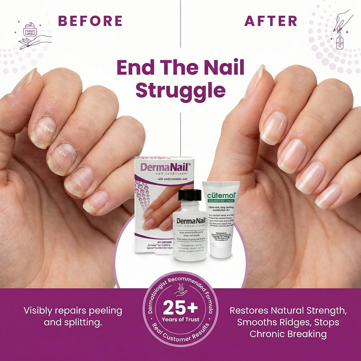 DermaNail Nail Conditioner 1oz - Strengthen & Restore Damaged Nails ...