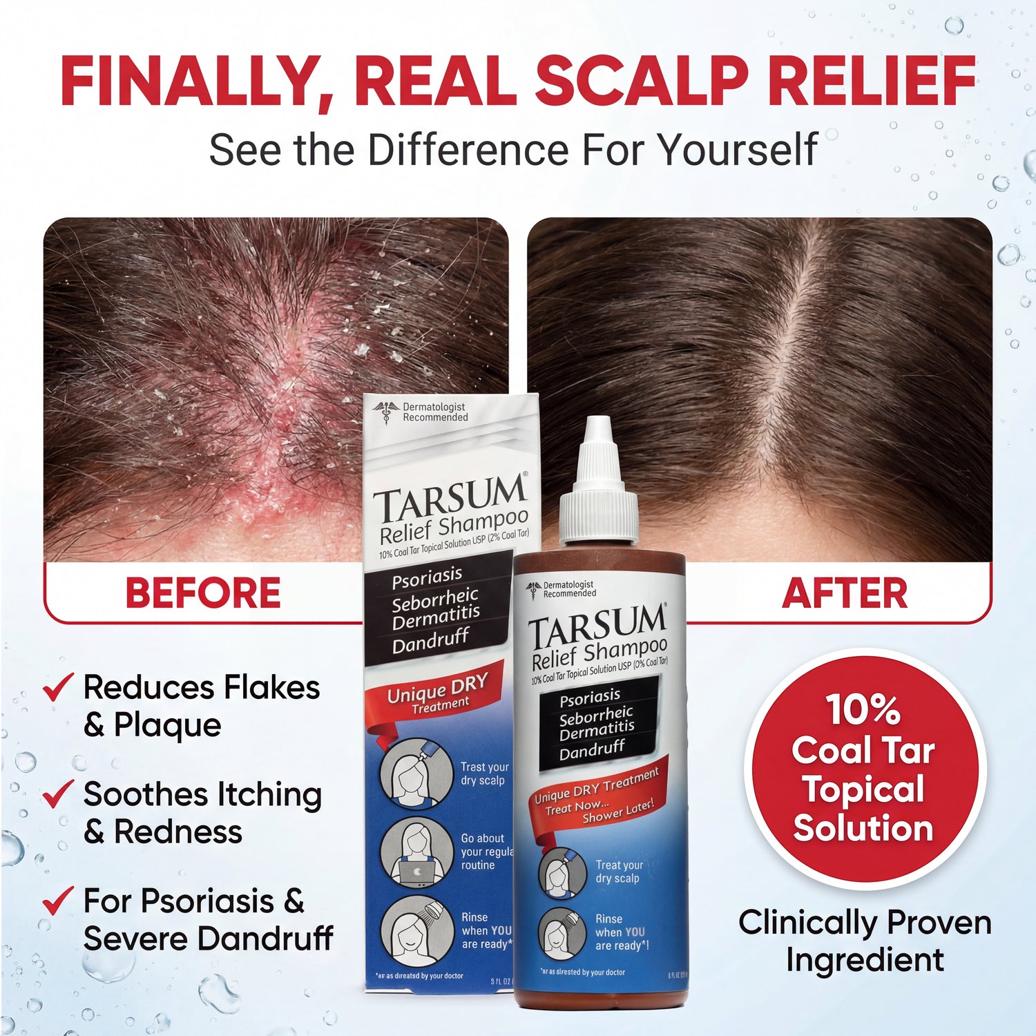 Tarsum Shampoo/Gel by Summers - 8 Oz